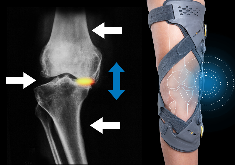 ���������� OA��ȣ�� ����